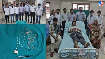 અમદાવાદ : શાકભાજી વેચતા વ્યક્તિની કિડનીમાંથી 250થી વધુ પથરીનું તબીબોએ સફળ ઓપરેશન કર્યું