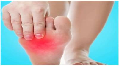 Summer Tips - ગરમીના કારણે પગના તળિયામાં બળતરા થાય છે ? તો રાહત મેળવવા અજમાવો આ ઉપાય