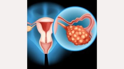 શું તમને પેટના નીચેના ભાગ છે દુ:ખાવો ? અવગણશો નહીં, હોય શકે છે અંડાશયનું કેન્સર