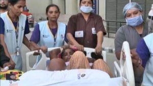 અમદાવાદની SVP હોસ્પિટલમાં આગ, દર્દીઓને અન્ય જગ્યાએ ખસેડવામાં આવ્યા