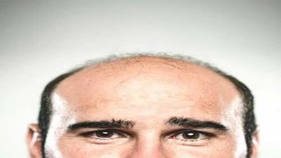 પુરુષો લગાવો આ Hair oils, નહીં પડે તમારા માથામાં ટાલ!