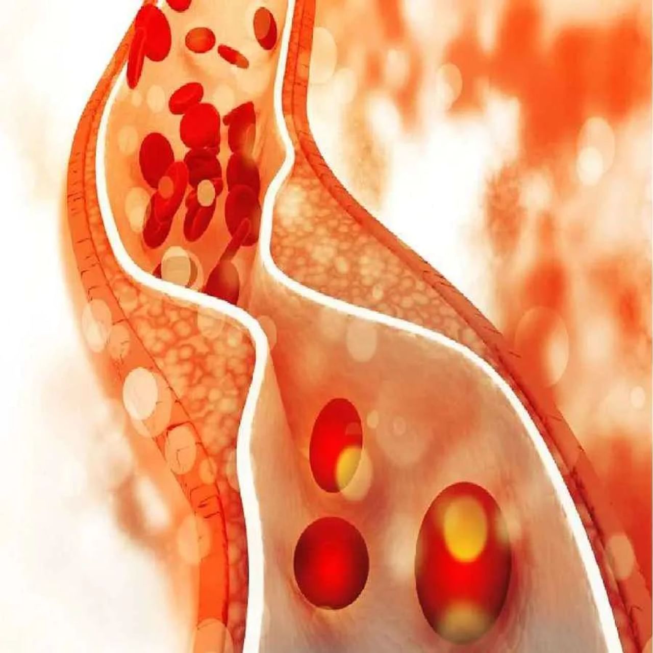 શરીરમાં કોલેસ્ટ્રોલ બે પ્રકારના હોય છે. એક HDL એટલે સારું કોલેસ્ટ્રોલ અને LDL એટલે ખરાબ કોલેસ્ટ્રોલ. ખરાબ કોલેસ્ટ્રોલ લોહીના પ્રવાહને અવરોધે છે. ખરાબ કોલેસ્ટ્રોલને કારણે હૃદય સંબંધિત સમસ્યાઓનો સામનો કરવો પડી શકે છે. આવી સ્થિતિમાં સારી જીવનશૈલી અને સ્વસ્થ આહાર લેવો ખૂબ જ જરૂરી છે. ચાલો જાણીએ કે ખરાબ કોલેસ્ટ્રોલ ઘટાડવા માટે તમે કયા શાકભાજીને આહારમાં સામેલ કરી શકો છો.