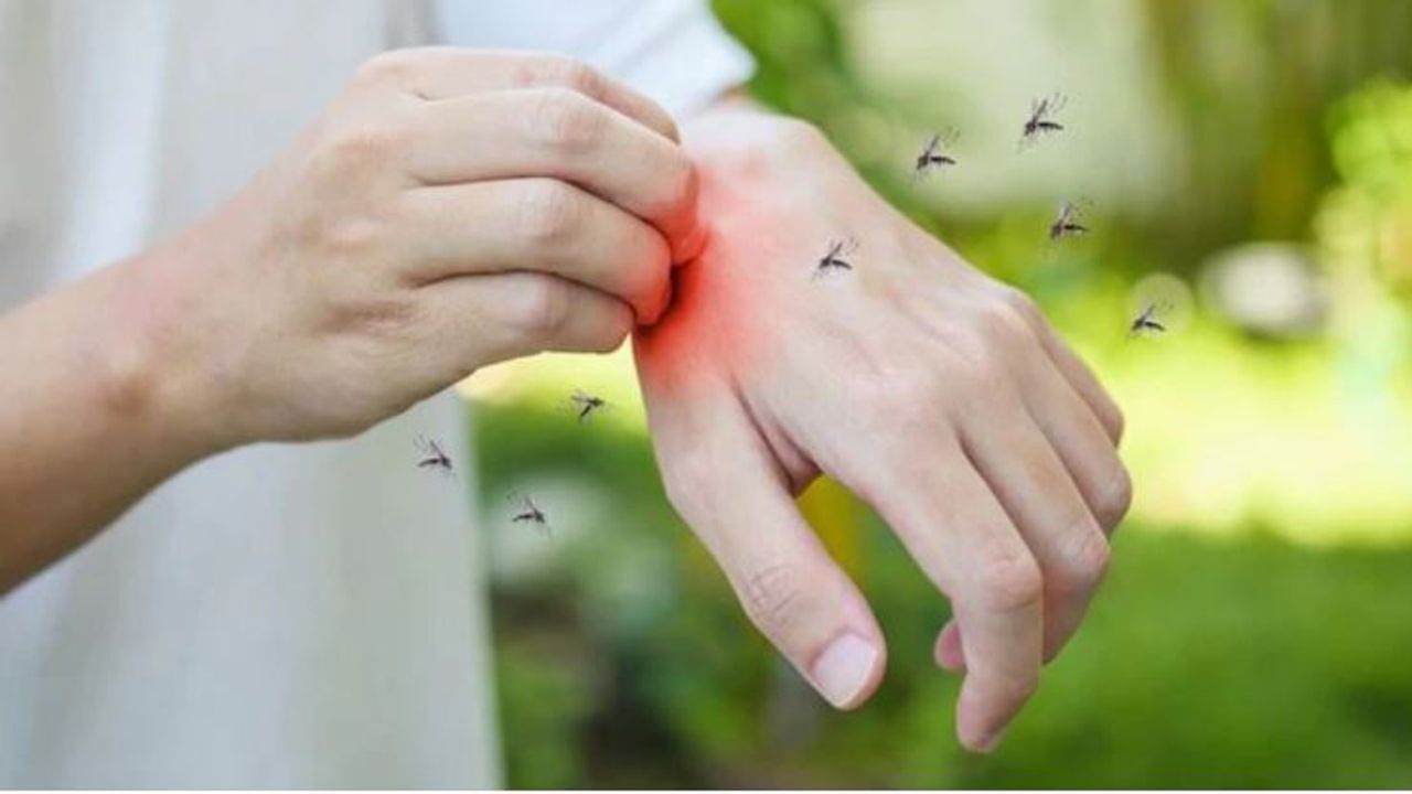 Home Remedy For Mosquitos : ચોમાસામાં મચ્છર ભગાડવા માટે અજમાવો આ ઘરેલુ ઉપાય, બિમારીઓથી બચી જશો