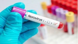 Norovirus: કેરળમાં કોરોના પછી નોરોવાયરસના કેસ આવ્યા, બે બાળકોને લાગ્યો ચેપ, જાણો કેટલો જીવલેણ છે આ રોગ?