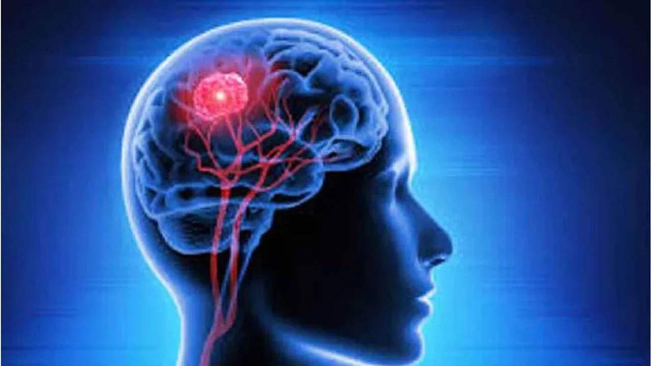 World Brain Tumor Day 2022: વર્લ્ડ બ્રેઈન ટ્યુમર ડેનો ઈતિહાસ, મહત્વ અને લક્ષણો જાણો
