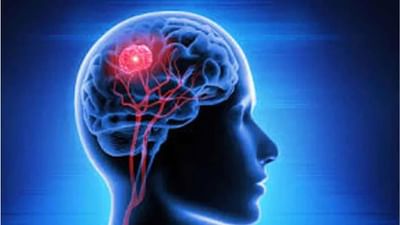 World Brain Tumor Day 2022:  વર્લ્ડ બ્રેઈન ટ્યુમર ડેનો ઈતિહાસ, મહત્વ અને લક્ષણો જાણો