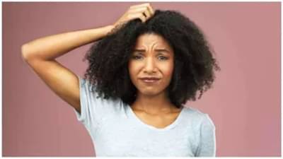 Home Remedies Dandruff : જો તમે વાળમાં ડેન્ડ્રફ અને ખંજવાળથી પરેશાન છો તો અજમાવો આ ઘરેલું ઉપાય, મળશે ફાયદો