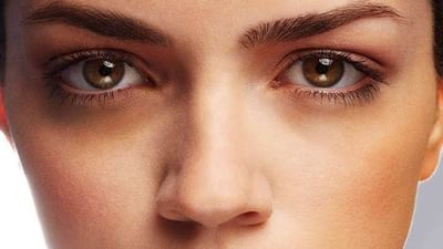 તમારા ડાર્ક સર્કલની સમસ્યા હવે થશે દૂર, અપનાવો આ Lifestyle Tips