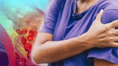 Cholesterol Problem : જયારે શરીરમાં વધી જાય છે હાઈ કોલેસ્ટ્રોલ, તો તમારા હાથ આપશે આ સંકેત