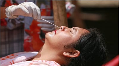 Coronavirus: કોવિડથી વધુ બીમાર થવાથી શરીરમાં આયર્નની ઉણપ થઈ શકે છે, આહારનું ધ્યાન રાખો