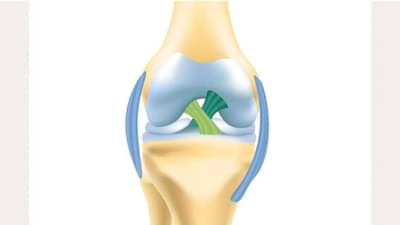 ઘૂંટણની ઈજા પછી સર્જરી કરાવવી છે ? ડૉક્ટર પાસેથી તેના ફાયદા અને ગેરફાયદા જાણો