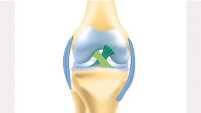 ઘૂંટણની ઈજા પછી સર્જરી કરાવવી છે ? ડૉક્ટર પાસેથી તેના ફાયદા અને ગેરફાયદા જાણો