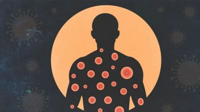 કેરળમાં મંકીપોક્સના શંકાસ્પદ દર્દીનું મોત, આરોગ્ય મંત્રી વીણા જ્યોર્જે કહ્યું, કારણ જાણવા તપાસ કરીશું