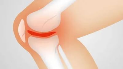 જો તમે ચિકનગુનિયા પછી રુમેટોઇડ આર્થરાઇટિસ પરેશાન છો, તો હોમિયોપેથીની આ પદ્ધતિઓ અપનાવો, મળશે રાહત