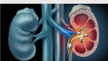 Prostate Cancer:  પેશાબ સંબંધિત આ સમસ્યાઓ પ્રોસ્ટેટ કેન્સરનું લક્ષણ હોઈ શકે છે