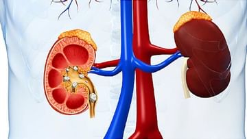 Kidney Stone : બીજ વાળા શાકભાજી સ્વાસ્થ્ય માટે હાનિકારક ! કિડની સ્ટોન ધરાવતા લોકોએ સાવચેત રહેવું