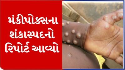 Jamnagar:  મંકીપોક્સ શંકાસ્પદ કેસના દર્દીનો લેબ રિપોર્ટ આવી ગયો, અમદાવાદ લેબમાં મોકલાયા હતા સેમ્પલ