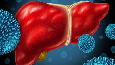 હેપેટાઇટિસ B અને C દર વર્ષે 14 લાખ લોકોનો ભોગ લે છે, શું તમે પણ બની રહ્યા છો શિકાર ?