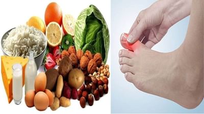 Uric Acid : આ રહ્યા એ સુપરફુડ જે યુરિક એસિડને ઓછું કરવામાં કરશે મદદ