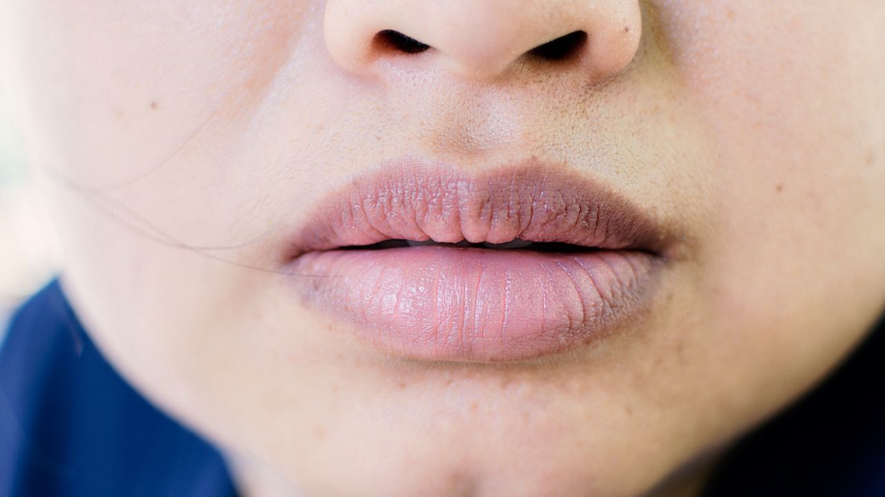 Dark Lips : હોઠની કાળાશથી પરેશાન છો? આજથી જ અપનાવો આ ઘરેલુ ઉપચાર