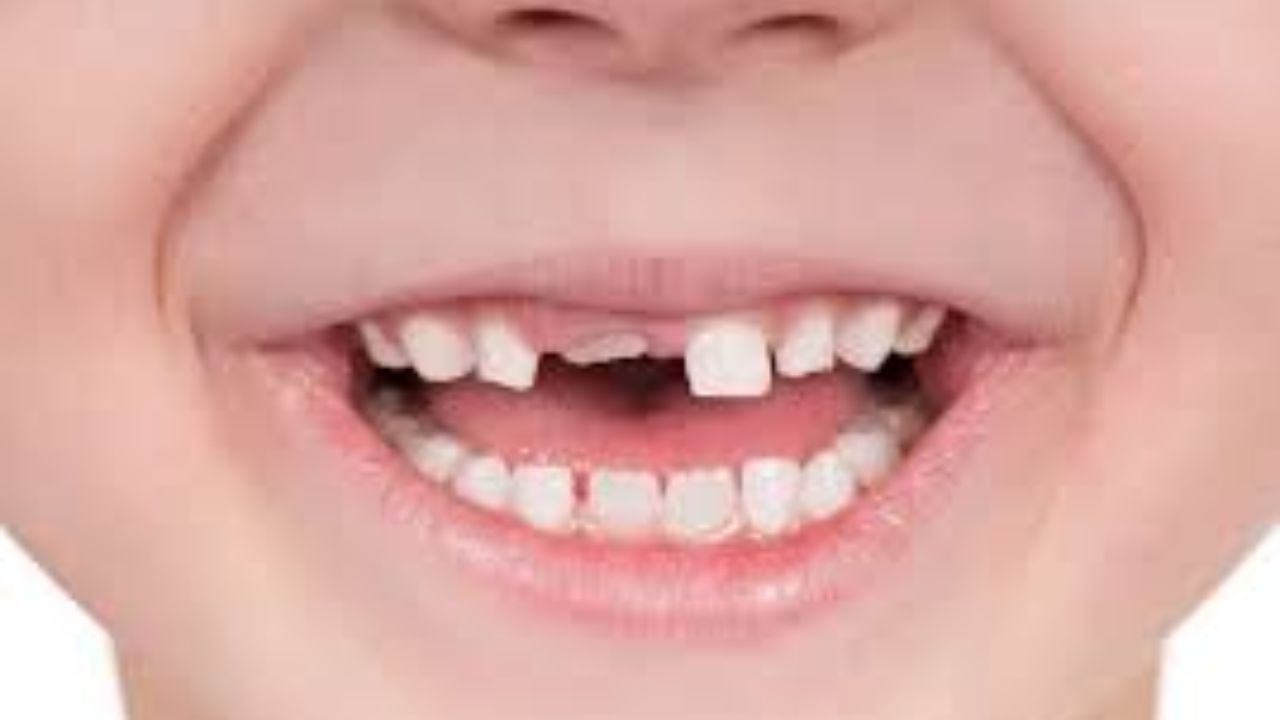 શા માટે બાળકોના દૂધના દાંત તુટી જાય છે ? જાણો આ પાછળનું કારણ