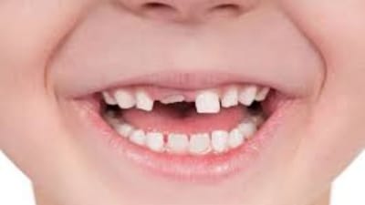 શા માટે બાળકોના દૂધના દાંત તુટી જાય છે ? જાણો આ પાછળનું કારણ