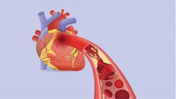 Heart Diseases: હૃદયની સ્થિતિ જાણવા માટે કરો આ બે ટેસ્ટ, તે એટેક સામે પણ રક્ષણ આપશે