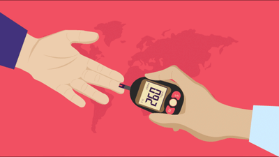 World Diabetes day 2022: ડાયાબિટીસ સાયલન્ટ કિલર છે, જાણો તેના લક્ષણો અને નિવારણની પદ્ધતિઓ