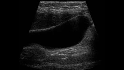 ગર્ભવતી મહિલાઓએ કેટલી વખત કરાવવી જોઇએ અલ્ટ્રાસાઉન્ડ સોનોગ્રાફી, જાણો શું કહે છે એક્સપર્ટ