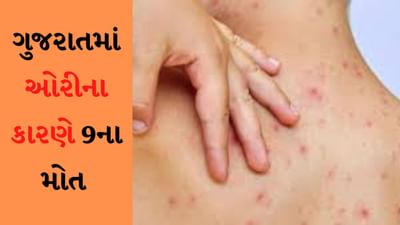 દેશમાં ઓરીના કારણે મોત મામલે ગુજરાત બીજા નંબરે, લોકસભામાં રજૂ કરાયા ઓરીના કેસ અને મોતના આંકડા