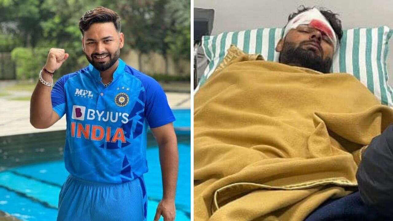 Rishabh Pant ની સારવાર BCCI ના તબિબો કરશે, બોર્ડ દ્વારા વિદેશ મોકલવાની