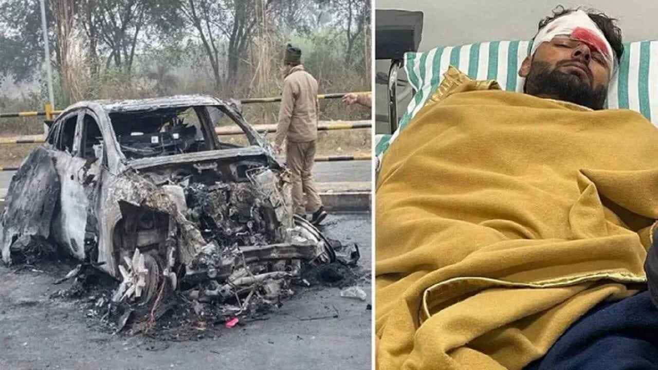 રિષભ પંતના કારના અક્સ્માતની જાણકારી ઉત્તરાખંડ પોલીસને હરિયાણા રોડવેજના એક ડ્રાઈવર અને કંડક્ટરને ફોન કરી આપી હતી. સુચના મળતા જ નારસલ ચેક પોસ્ટ પર તૈનાત ઉત્તરાખંડ પોલીસના જવાનો પંતની પાસે પહોંચ્યા અને તેને પ્રાર્થમિક સારવાર માટે હોસ્પિટલ લઈ ગયા હતા. (PC-TWITTER)