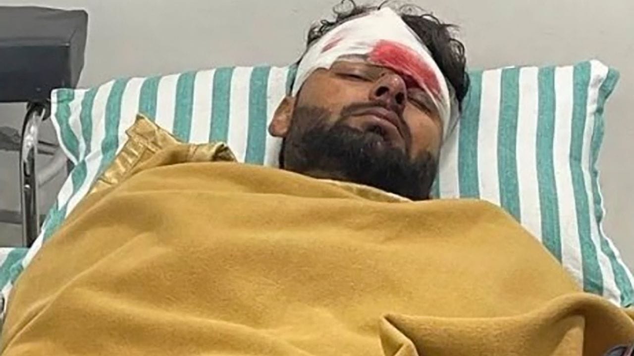 રિષભ પંતના પગમાં ફ્રેક્ચર થયું છે. તેના માથામાં ઈજા છે. ઉપરાંત, પીઠ અને હાથ પર ઈજા છે. જોકે, સારી વાત એ છે કે તેની સાથે મોટો અકસ્માત થયો હોવા છતાં તેનો જીવ બચી ગયો હતો. તમને જણાવી દઈએ કે અકસ્માત બાદ તેમની કારમાં આગ લાગી હતી પરંતુ પંત ​​સમયસર બહાર નીકળી ગયો હતો.