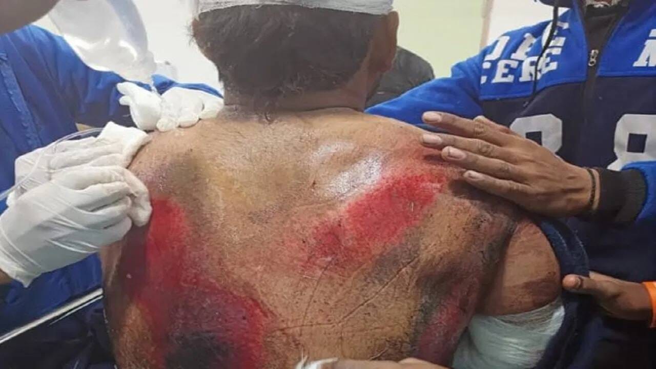 રિષભ પંતને ડોક્ટરોએ ઈજા બહાર હોવાનું જણાવ્યું છે. પંતને દેહરાદૂનની મેક્સ હોસ્પિટલમાં મોકલવામાં આવ્યો, જ્યાં તેની હાલત સ્થિર હોવાનું કહેવાય છે (PC-TWITTER)