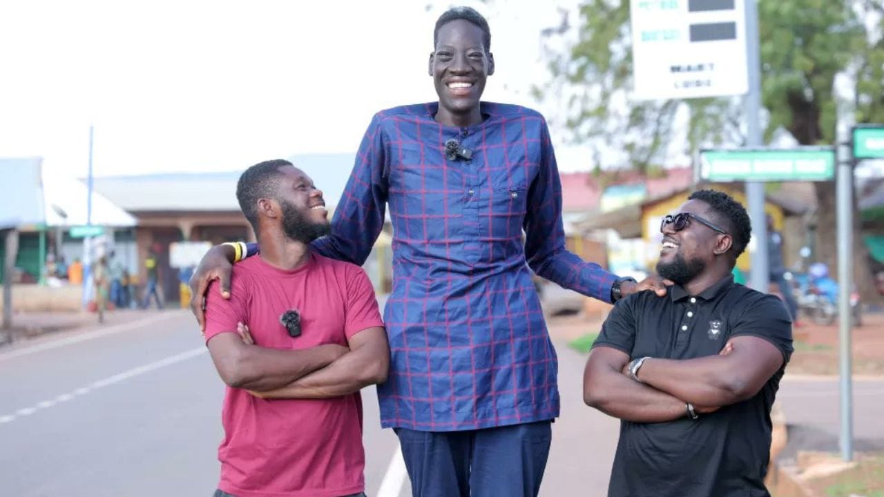 અબ્દુલ સમેદ માર્ફાન સિનડ્રોમની બીમારીથી પીડિત છે. તે એક આનુવંશિક રોગ છે. આ બીમારીમાં કરોડરજ્જુ અસાધારણ રીતે વધા છે. તેનાથી શરીરની માંશપેશી પર પણ અસર પડે છે.  માર્ફાન સિનડ્રોમને કારણે શરીરના અંગોની લંબાઈ વધતી રહે છે. 