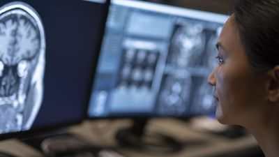 ગુજરાતમાં ભારતના સૌ પ્રથમ બ્રેઇન સ્ટ્રોક કેર નેટવર્કની શરૂઆત, દર્દીને સમયસર યોગ્ય સારવાર મળી શકશે