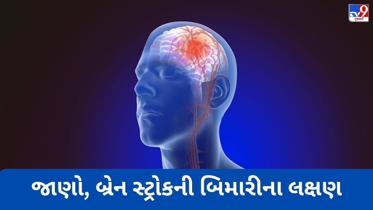 દેશમાં દર 4 મિનિટે એક વ્યક્તિનો જીવ લઈ રહ્યો છે Brain Stroke, જાણો બિમારીના લક્ષણ