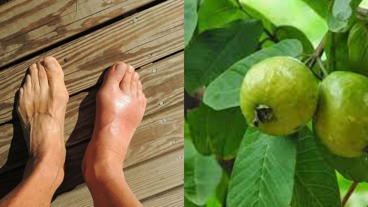 Uric Acid : જામફળના પાન છે યુરિક એસિડનો અકસીર ઉપાય, ખાવાથી મળે છે તુરંત જ રાહત