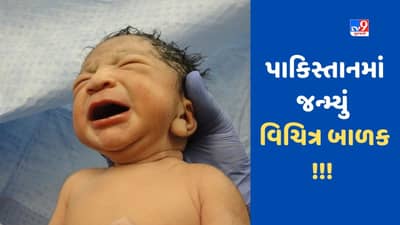OMG! પાકિસ્તાનમાં બે પ્રાઈવેટ પાર્ટ સાથે જન્મ્યું વિચિત્ર બાળક, ડોક્ટરો પણ દંગ રહી ગયા