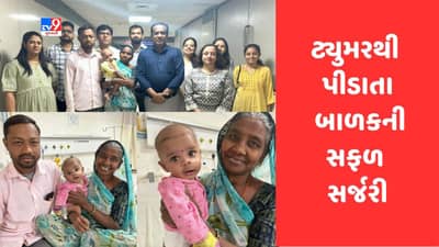 Ahmedabad: સિવિલ હોસ્પિટલના તબીબોને 5 મહિનાના બાળકના જડબાના ટ્યુમરની જટીલ સર્જરીમાં મળી સફળતા, 95 ટકા મોં માં ફેલાયેલુ હતુ ટ્યુમર