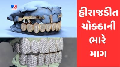 Surat: શોખ બડી ચીઝ ! સુરતમાં સોનાચાંદી અને હીરા-જડિત દાંતના ચોકઠાની વિદેશમાં ભારે માગ, ડાયમંડ જડિત ચોકઠાએ જમાવ્યું આકર્ષણ