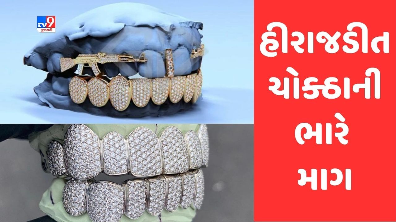 Surat: શોખ બડી ચીઝ ! સુરતમાં સોનાચાંદી અને હીરા-જડિત દાંતના ચોકઠાની વિદેશમાં ભારે માગ, ડાયમંડ જડિત ચોકઠાએ જમાવ્યું આકર્ષણ