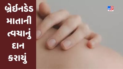 Rajkot:વિશ્વ માતૃ દિને બ્રેઇનડેડ માતાની ત્વચાનું કરાયું દાન, બીજું સ્કીન ડોનેશન