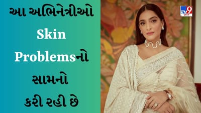 રશ્મિકા મંદાનાથી લઈને સોનમ કપૂર સુધી, ત્વચાની આ સમસ્યાઓ સામે લડી રહી છે એક્ટ્રેસ