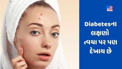 Diabetesના લક્ષણો ત્વચા પર પણ દેખાય છે, આ બાબતોને અવગણશો નહીં