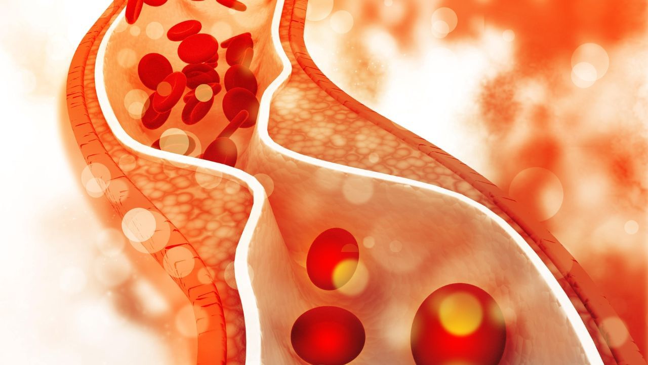 Cholesterol Control Tips: શરીરમાં ખરાબ કોલેસ્ટ્રોલને ઘટાડવુ છે તો ના કરો આ 4 ભૂલ