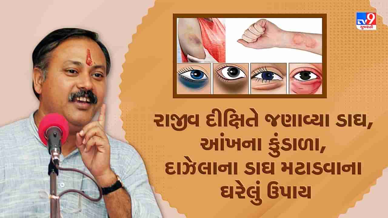 Rajiv Dixit Health Tips: ડાઘ, આંખના કુંડાળા, દાઝેલાના ડાઘ થશે દૂર, રાજીવ દીક્ષિતે જણાવ્યા ઘરેલું ઉપાય