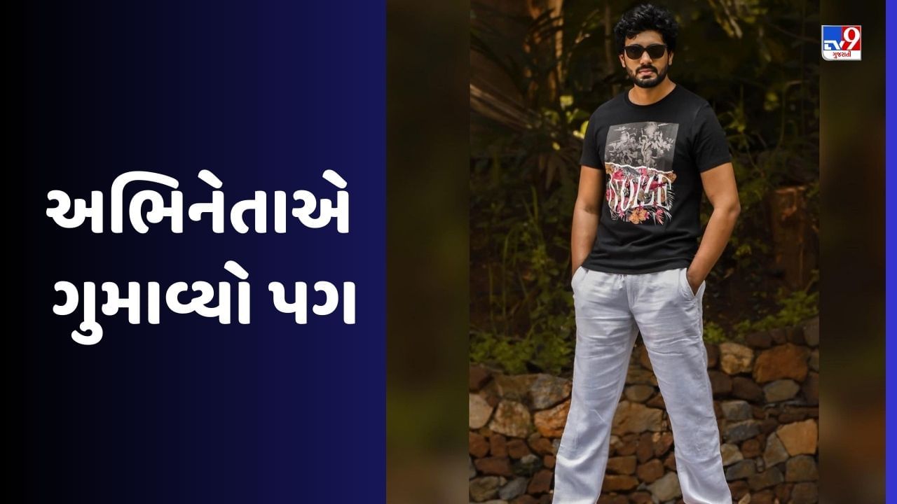  ધ્રુવનના નામથી ઓળખાતા કન્નડ ફિલ્મ અભિનેતા સૂરજ કુમાર વિશે એક આશ્ચર્યજનક સમાચાર સામે આવી રહ્યા છે. તાજેતરમાં જ તેનો અકસ્માત થયો હતો, જે બાદ તેનો એક પગ કાપવો પડ્યો હતો. આ સમાચાર સામે આવ્યા બાદ સૂરજ કુમારના ચાહકો ખુબ નાખુશ જોવા મળી રહ્યા છે. રિપોર્ટ અનુસાર, 24 જૂનના રોજ તે મૈસુરથી બાઇક પર ઉટી જવા નીકળ્યો હતો. અને તે મૈસુર-ગુંડલુપર હાઈવે પર અકસ્માતનો ભોગ બન્યો. 