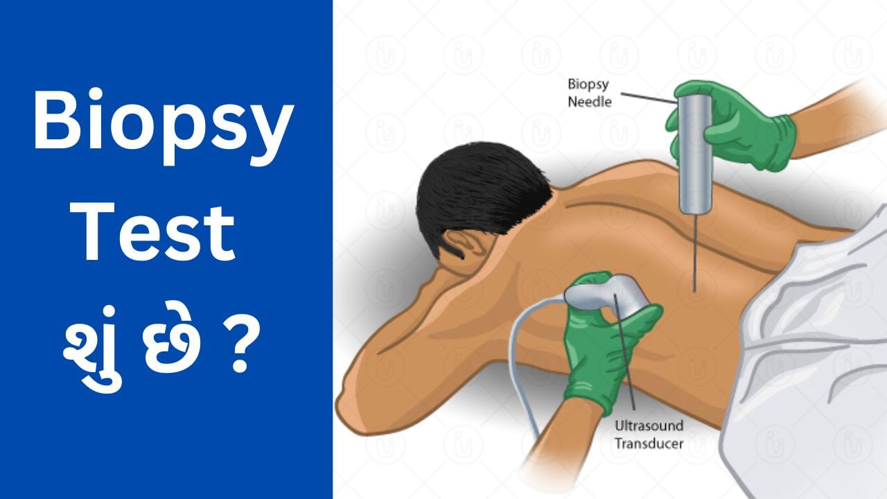Biopsy Test : બાયોપ્સી ટેસ્ટ શું છે અને તે કેવી રીતે કરવામાં આવે છે ? આ ટેસ્ટથી શું જાણી શકાય
