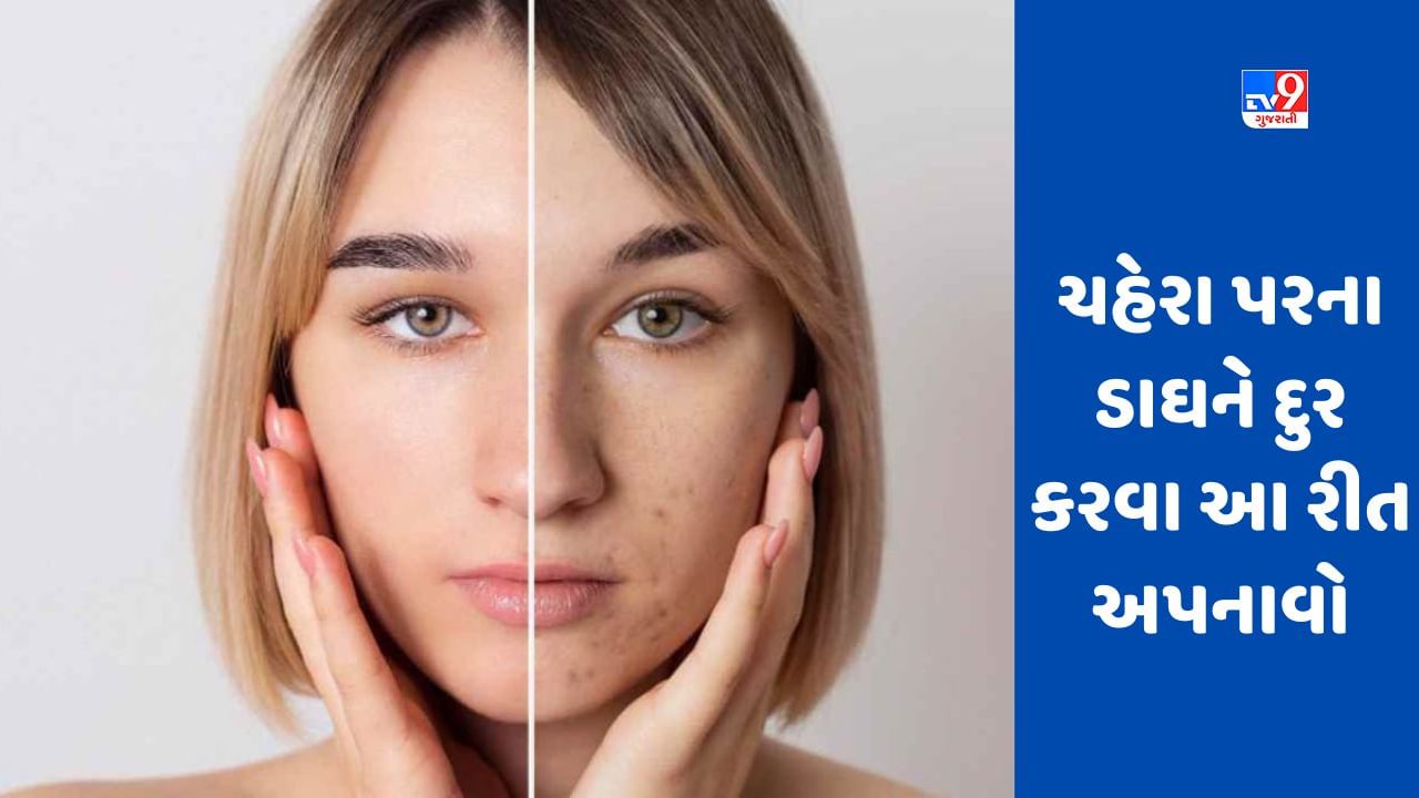 Dark Spots Removal:  જો તમે ચહેરાના ડાઘ-ધબ્બા દૂર કરવા માત્ર આ રીત અપનાવો